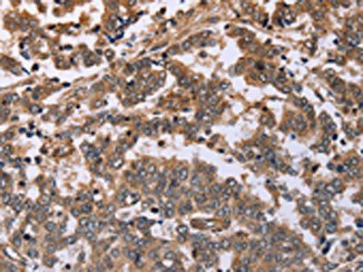 FAF1 Antibody