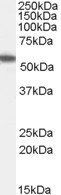 Goat anti-ETEA / UBXD8 Antibody