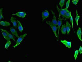 FAH Antibody