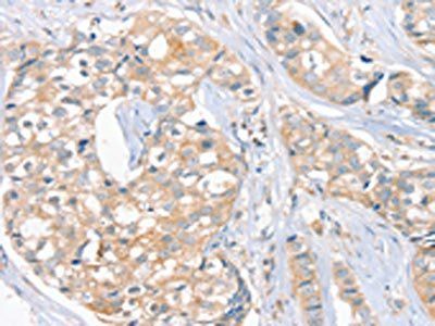 FAIM3 Antibody