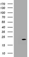 FAIM3 (FCMR) antibody