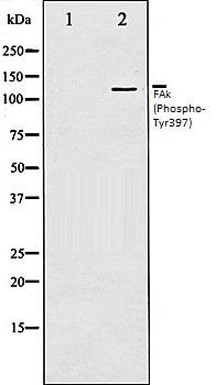 FAk (Phospho-Tyr397) antibody
