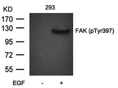 FAK (Phospho-Tyr397) Antibody
