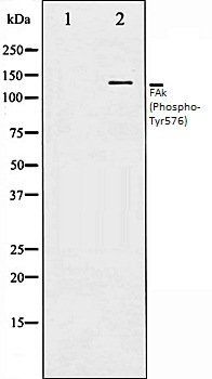 FAk (Phospho-Tyr576) antibody