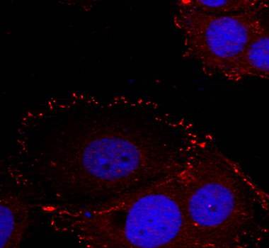 FAK (phospho-Tyr576/Tyr577) Antibody