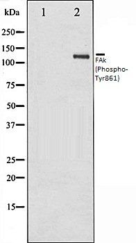 FAk (Phospho-Tyr861) antibody
