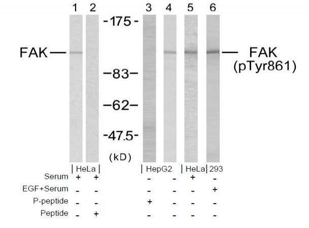 FAK (Phospho-Tyr861) Antibody
