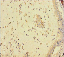 FAM107A Antibody