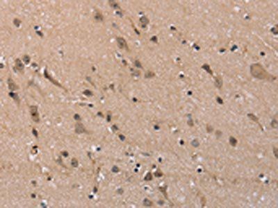 FAM107A Antibody