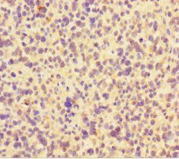 FAM117B Antibody