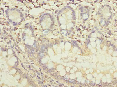 FAM118B Antibody