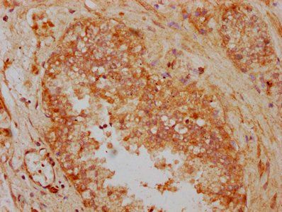 FAM13A Antibody