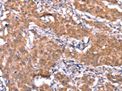 FAM13B Antibody