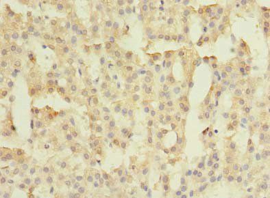 FAM149B1 antibody