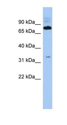 FAM161B antibody