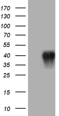FAM170A antibody