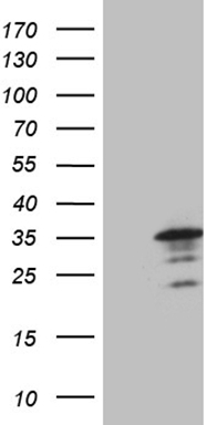 FAM170A Antibody