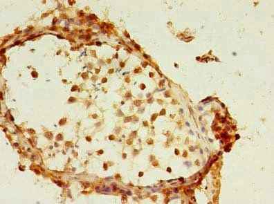 FAM174A Antibody