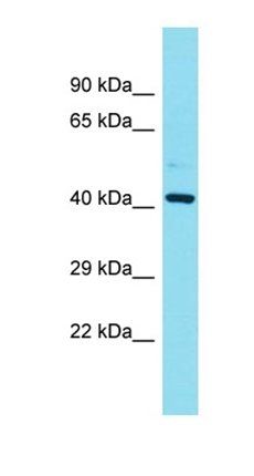 FAM181B antibody