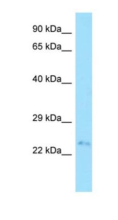 FAM207A antibody