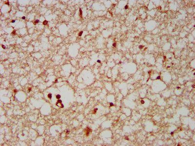 FAM20C Antibody