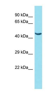 FAM221B antibody