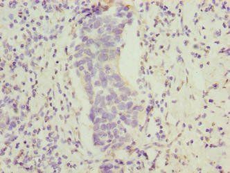 FAM222B Antibody