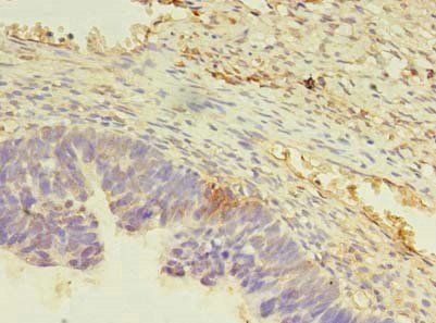FAM32A Antibody