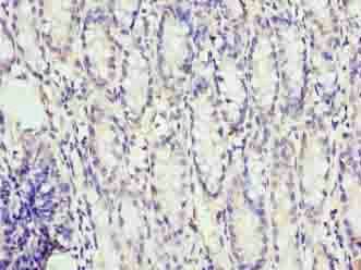FAM3B Antibody