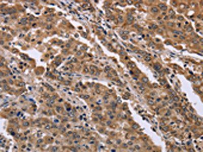 FAM3B Antibody