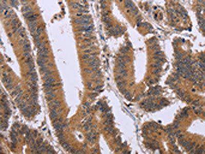 FAM3B Antibody
