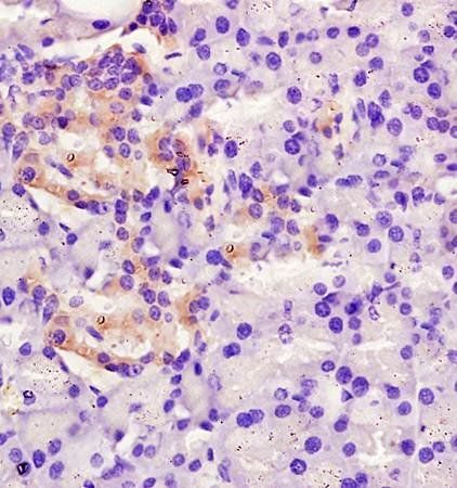 FAM3B Rabbit Polyclonal Antibody