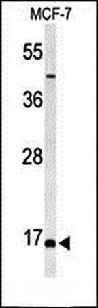 FAM44B antibody