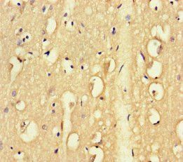 TENT5C Antibody