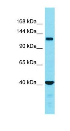 FAM65A antibody