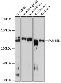 FAM65B antibody