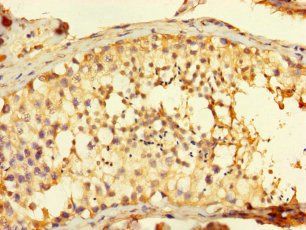 FAM71A Antibody