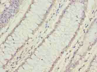 FAM78A Antibody