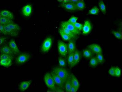 FAM83D Antibody