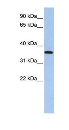 FAM84A antibody