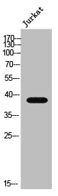 FAM84B Antibody
