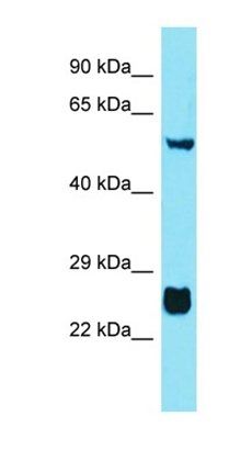 FAM90A12P antibody