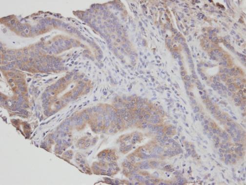 FAN Rabbit Polyclonal Antibody