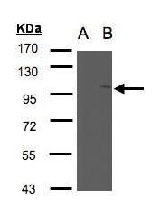 FAN Rabbit Polyclonal Antibody