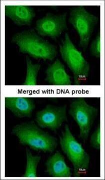 FANCA antibody [N1], N-term