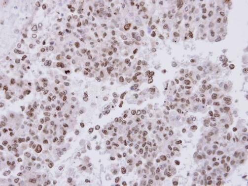 FANCA Rabbit Polyclonal Antibody
