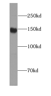 FANCD2 (Phospho-S330) antibody