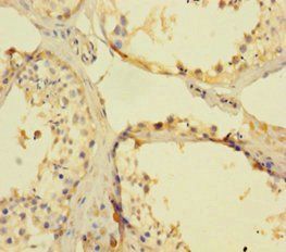 FANCD2 Antibody