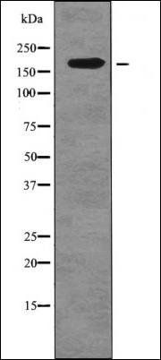 FANCD2 (Phospho-Ser717) antibody