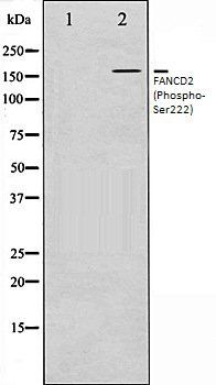 FANCD2 (Phospho-Ser222) antibody
